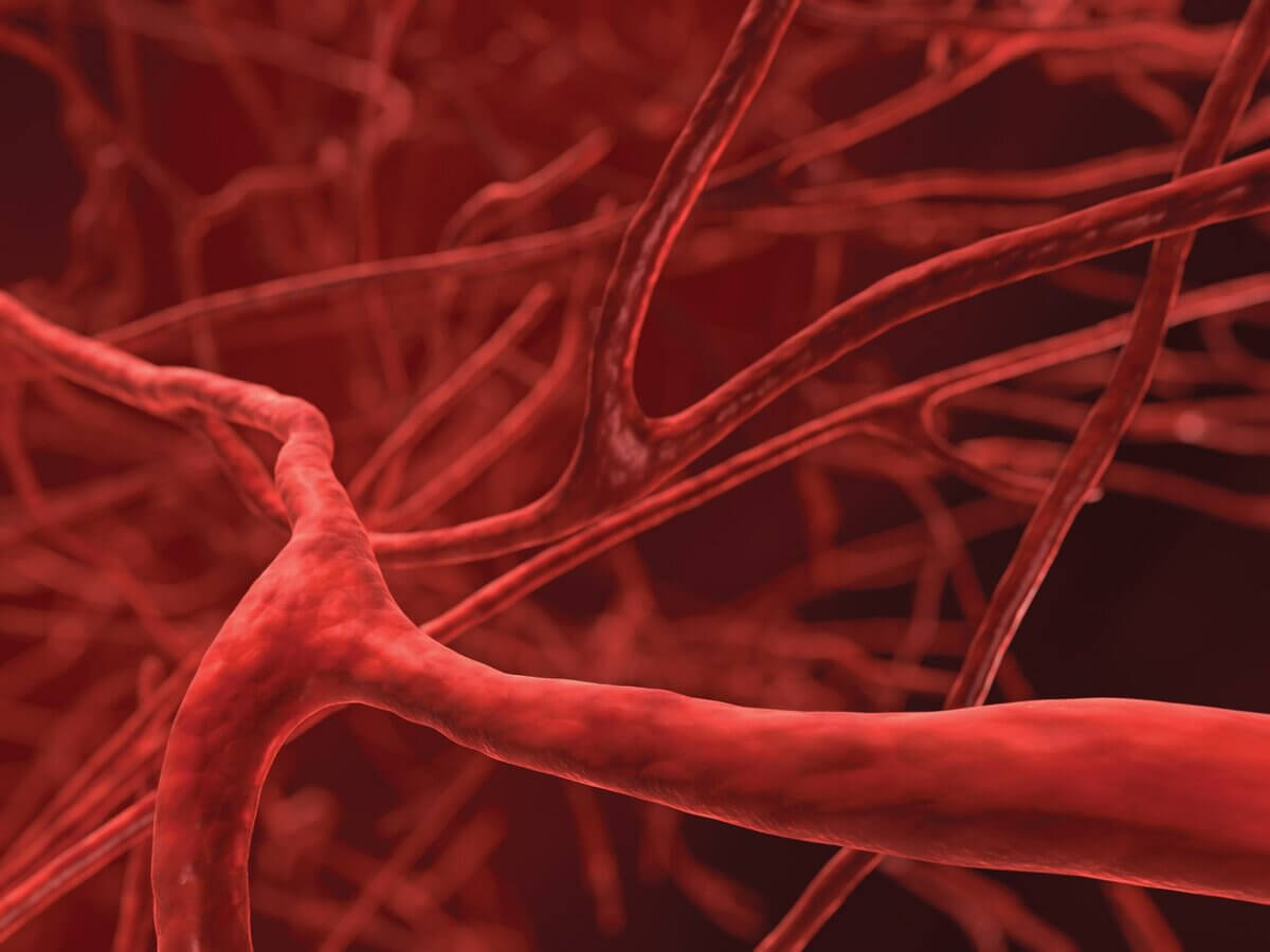 Giảm lưu thông máu là một trong những nguyên nhân chính dẫn đến suy tĩnh mạch 