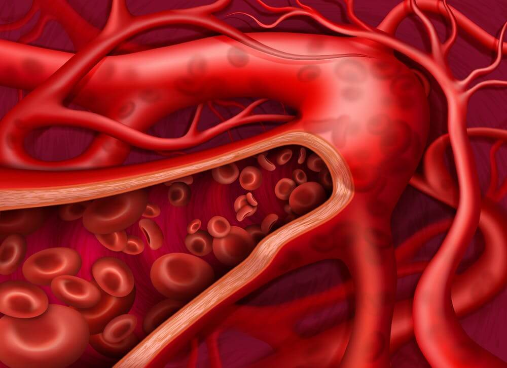 Khi van tĩnh mạch suy yếu thì máu trong tĩnh mạch đổ dồn xuống chân và ứ đọng